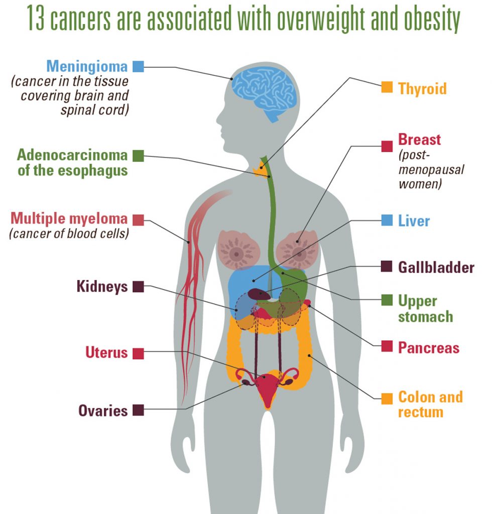 The various Obesity-Related Cancers